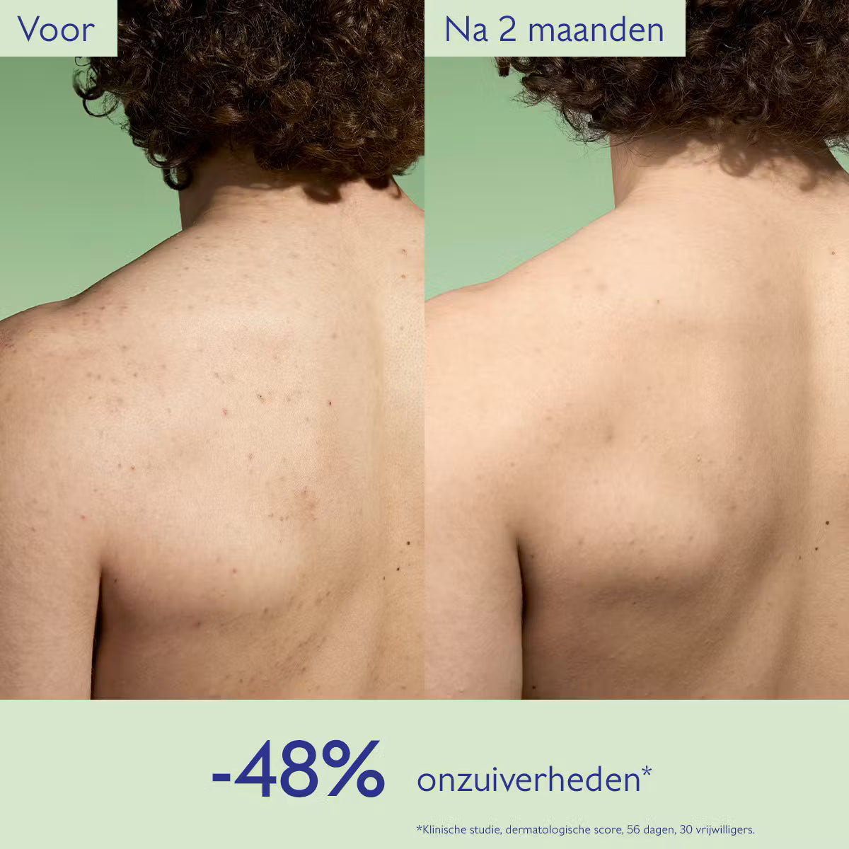 Caudalie Vinopure Zuiverende Lotion