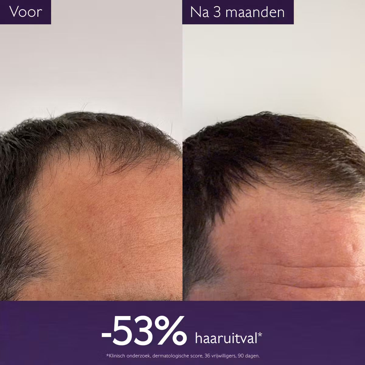 Caudalie Anti-haaruitval Serum