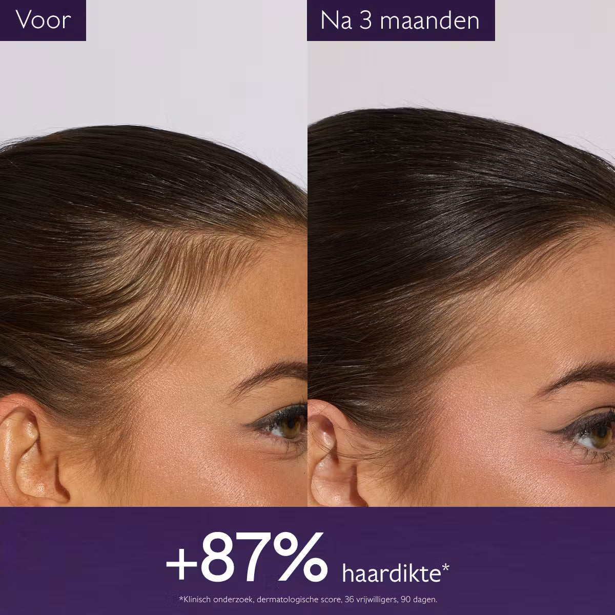 Caudalie Anti-haaruitval Serum