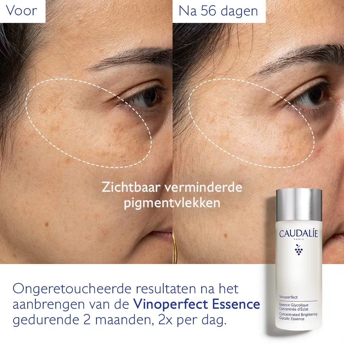 Caudalie Vinoperfect Geconcentreerde Éclat Glycolic Essence