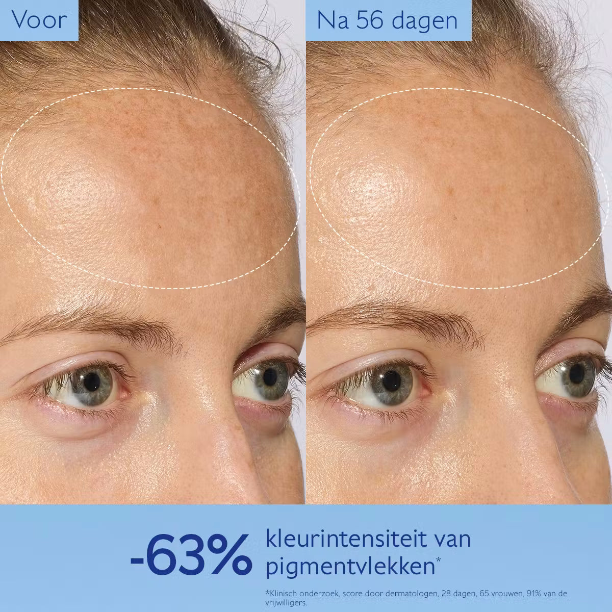 Caudalie Vinoperfect Glow Serum tegen Pigmentvlekken