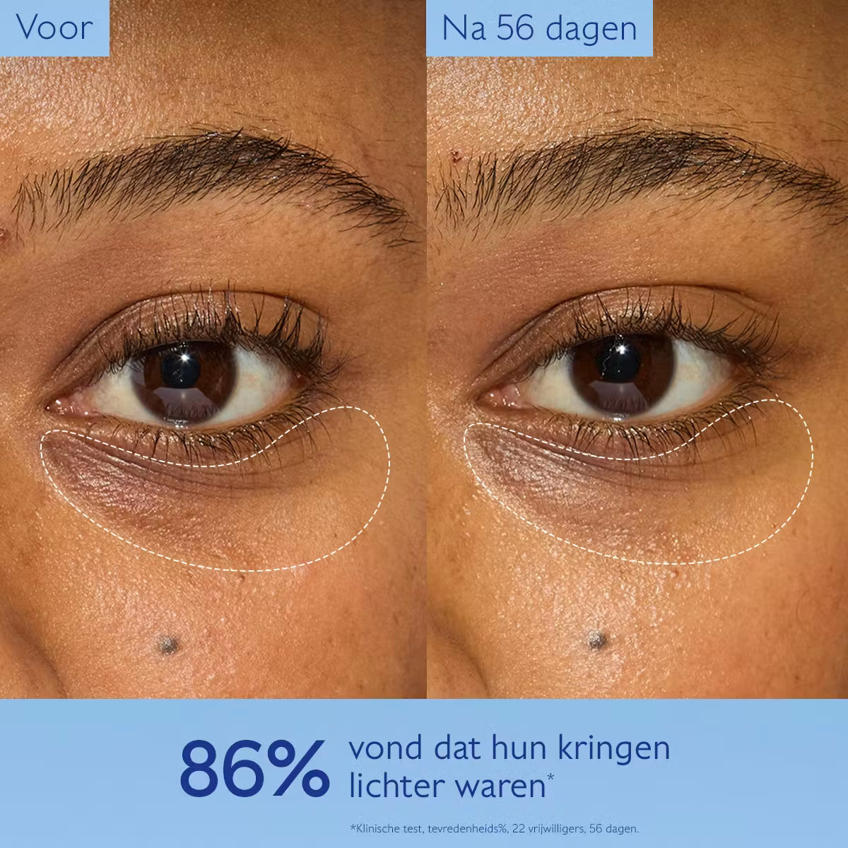 Caudalie Vinoperfect Verhelderende Oogverzorging