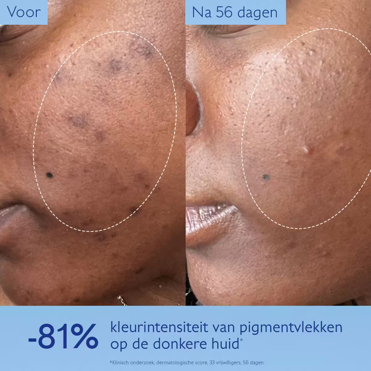 Caudalie Vinoperfect Glow Serum tegen Pigmentvlekken